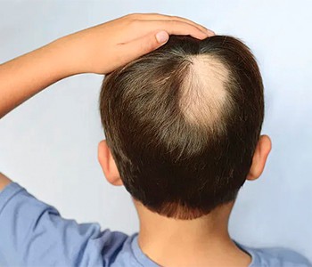 Как сильно древние пытались лечить выпадение волос