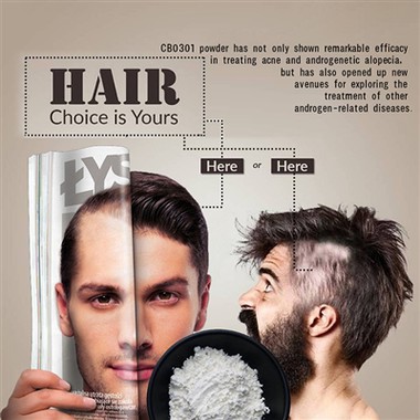 Почему у меня появляются прыщи на коже головы? Эксперты объясняют появление п...