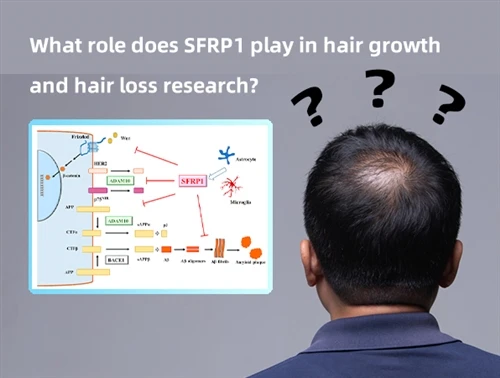 Какую роль играет SFRP1 в исследованиях роста и выпадения волос?