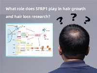 Какую роль играет SFRP1 в исследованиях роста и выпадения волос?