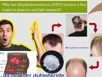 Почему ДГТ стал ключевой целью в исследованиях простаты и волос